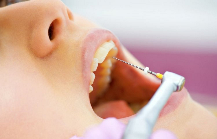 Leczenie endodontyczne Dzierżoniów